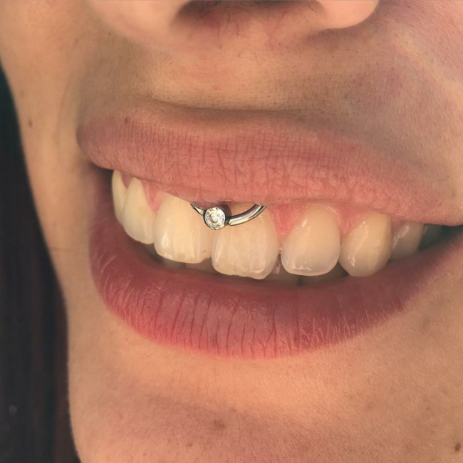 smiley piercing aftercare