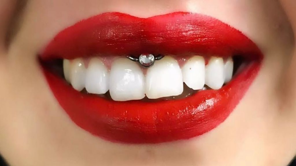 smiley piercing infection